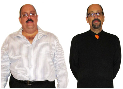 Henk's Gastric Sleeve 